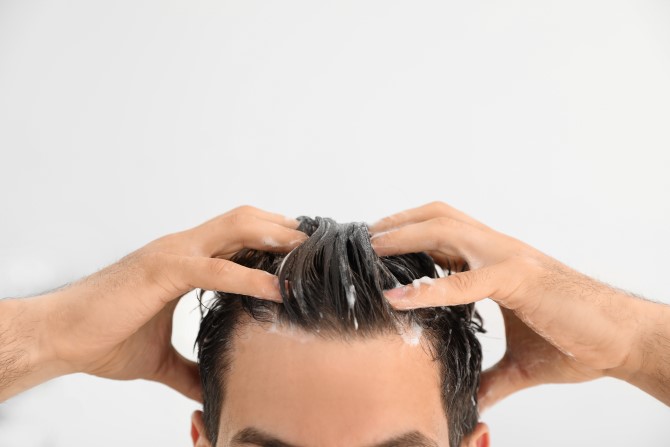 Treatments for scalp psoriasis